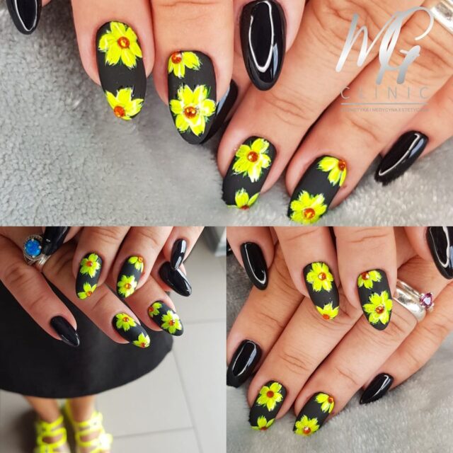 mg clinic aleksandrow lodzki manicure pedicure (10)